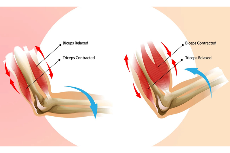 Biceps Tendinitis